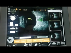 Разрешение машины 10MHz блока развертки функции вычисления IOL ультразвуковое высокое супер осевое