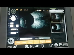 Машина 10MHz развертки b развертки вентилятора наблюдающ ретинальным отрывом