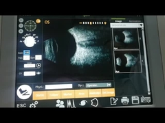 Машины блока развертки b рассмотрение заболеванием тела ультразвуковой электромагнитное стекловатое