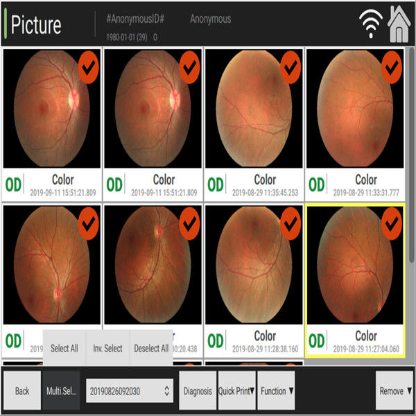3.3mm автоматизированная камера Fundus наблюдающ изменением цвета атрофии зрительного нерва
